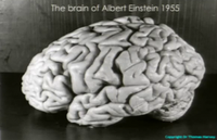 cerveau